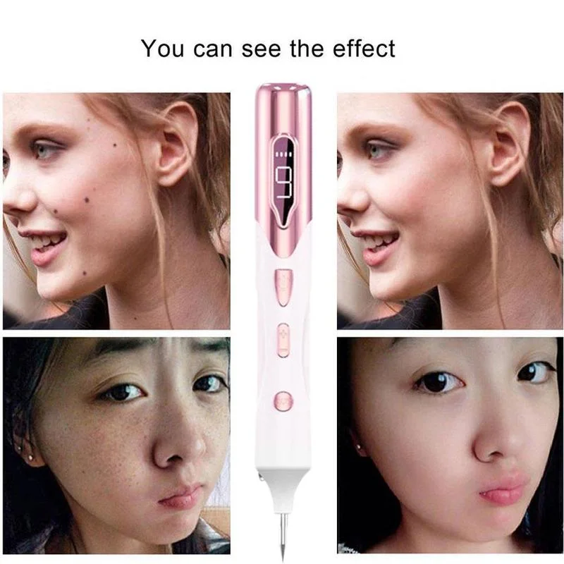 High Quality Multi Speed Level Adjustable Home Use Professional Wart Spot Mole Removal Pen Plasma Pen