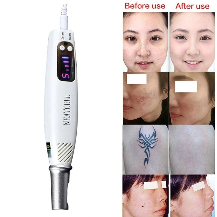 Portable Handheld Spot Tattoo Removal Picosecond Laser Pen Beauty Device