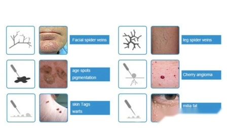 Ce Multipurpose Varicos Vein Therapy System Portable RF Vascular Mole Removal High Frequency Galvanic Facial Machine